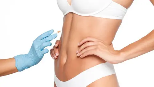 Пластика след издълбаване